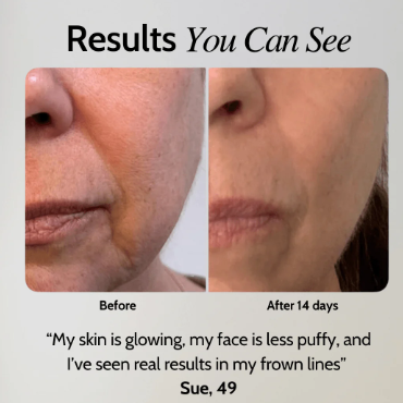 EMS Facial Toner Gel and Device